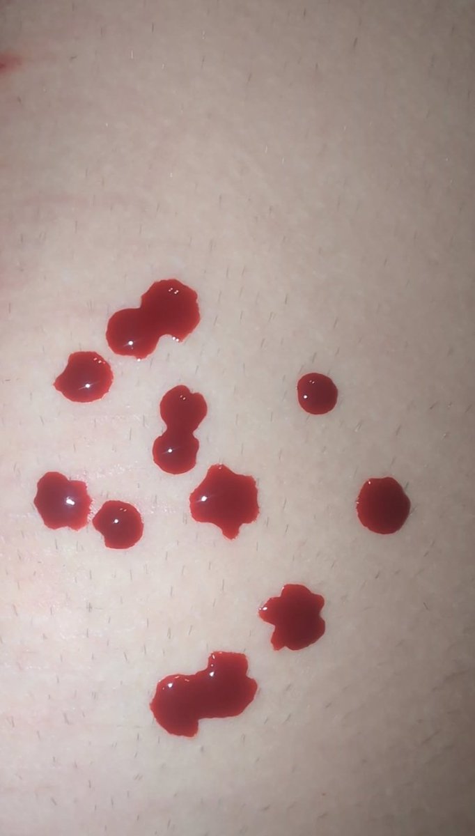 ADeadGekkocuts's tweet photo. thought this was cute 

!!!! FAKE BLOOD, NOT REAL!!!
#shtwt https://t.co/q9q463xlDh