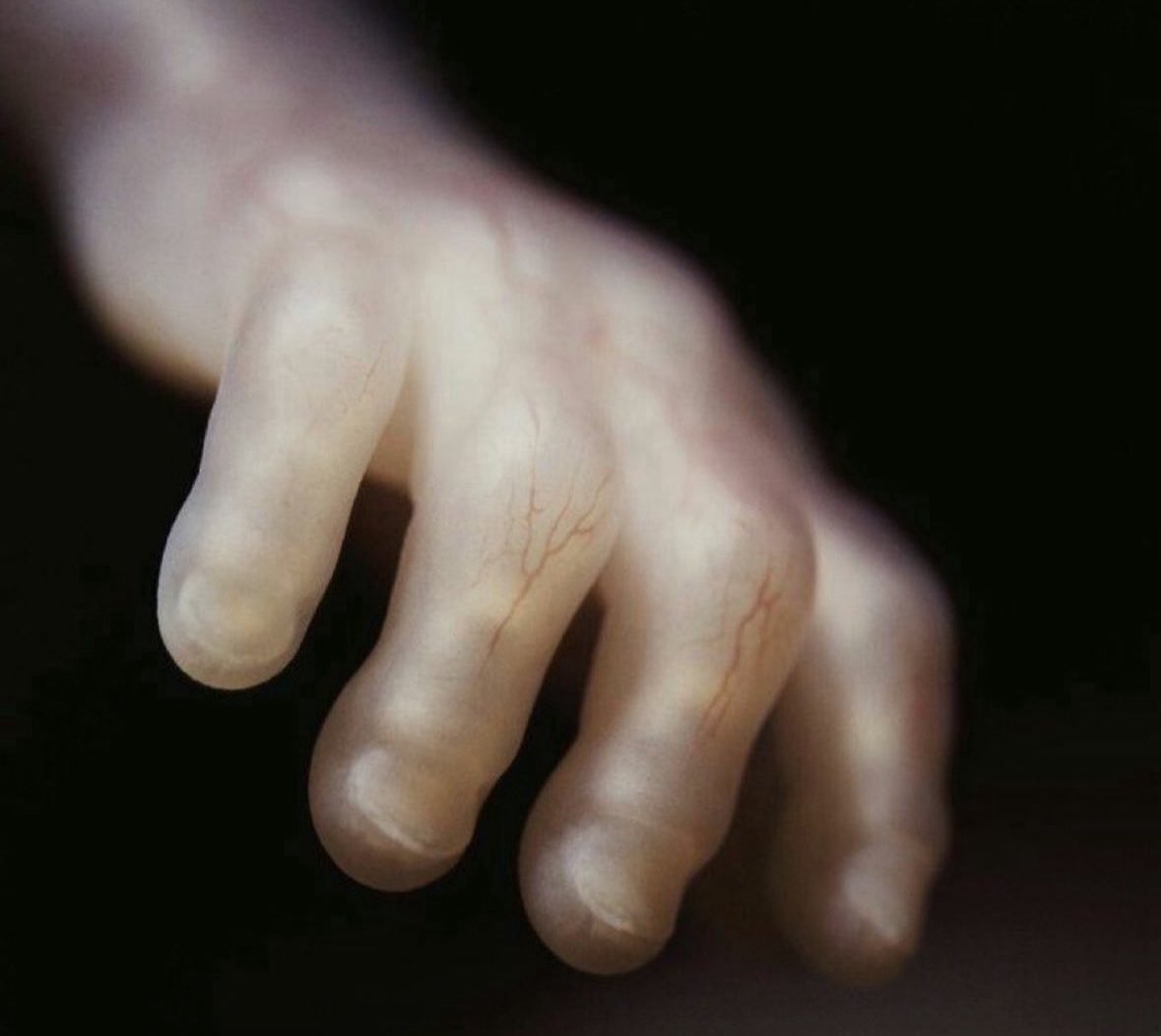 annamlulis's tweet photo. This is the hand of a 17-week-old unborn baby.

Not “just a clump of cells”

A living, developing human child with tiny fingers and toes.

Every child is worthy of life. https://t.co/T4nM5T6Hok