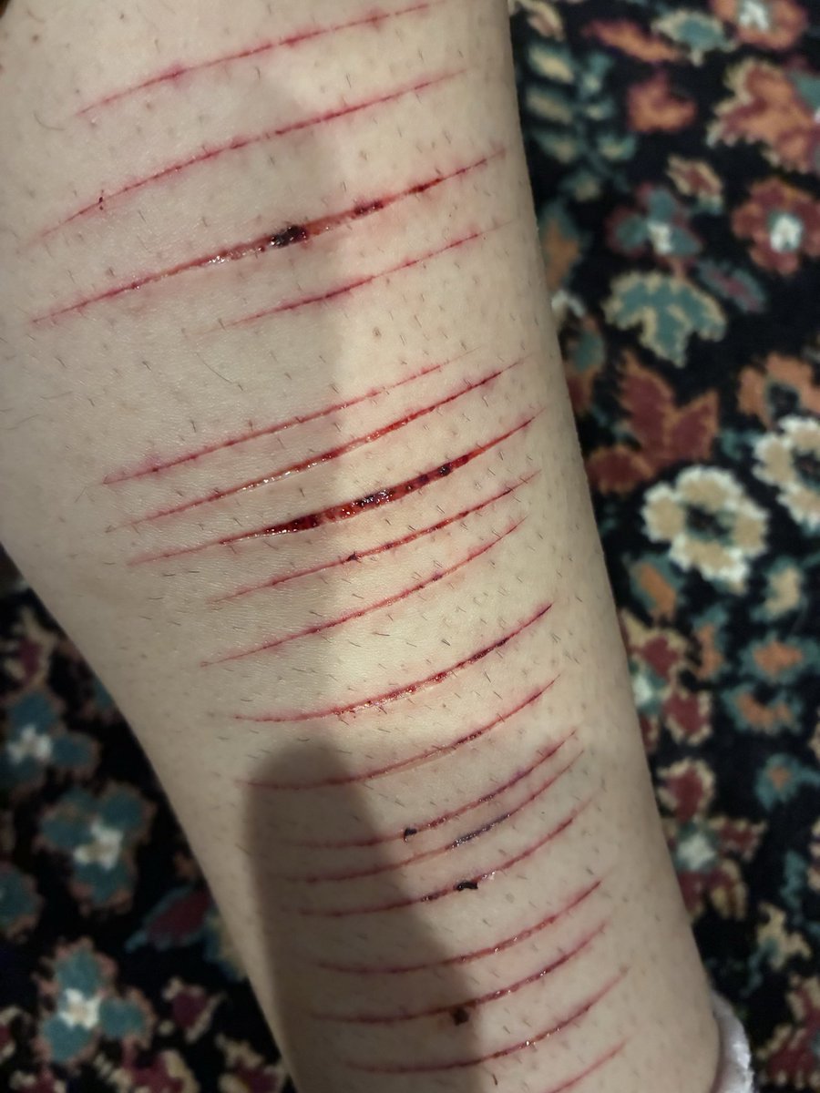natisagun's tweet photo. are these all just cat scratches? #shtwt https://t.co/ZVZeQl7zvv