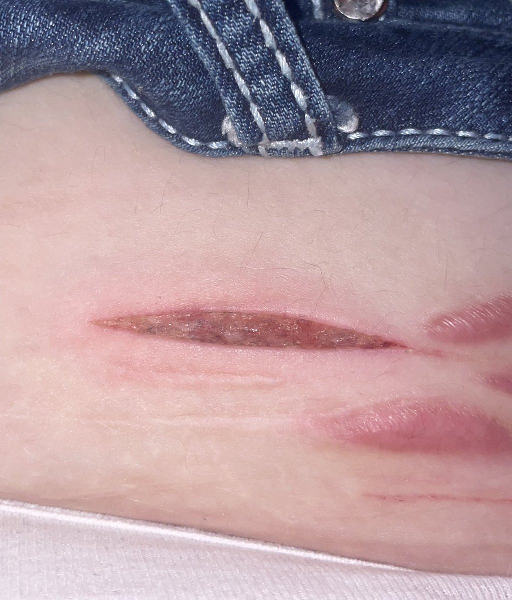 Suaoftwt's tweet photo. More healing process, FAKE SFX NOT REAL https://t.co/l3wRcTdK2R