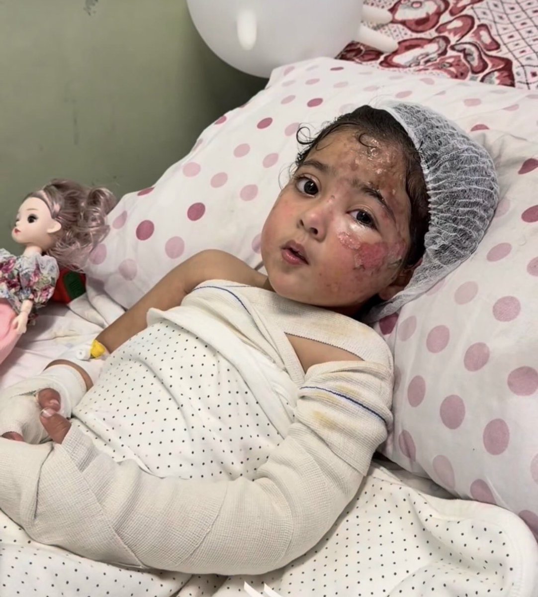 im_PULSE's tweet photo. This is Maryam Ahmed Ghanem. She was rescued from the fire caused by Israeli bombing that burned her mother in front of her eyes. Israel had already killed her father. She is now another one of Gaza's WCNSF (Wounded Child, No Surviving Family) https://t.co/8826DWLMDq