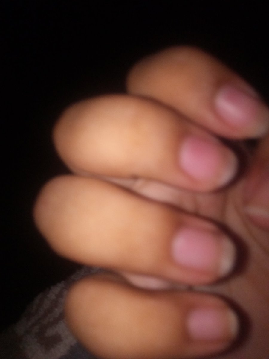 adicctoeb's tweet photo. Pregunta sería. ¿ Te puedes masturbar teniendo las uñas algo largas?.

Adjunto foto de cómo se ven mis uñas. https://t.co/RzoRITl6L0