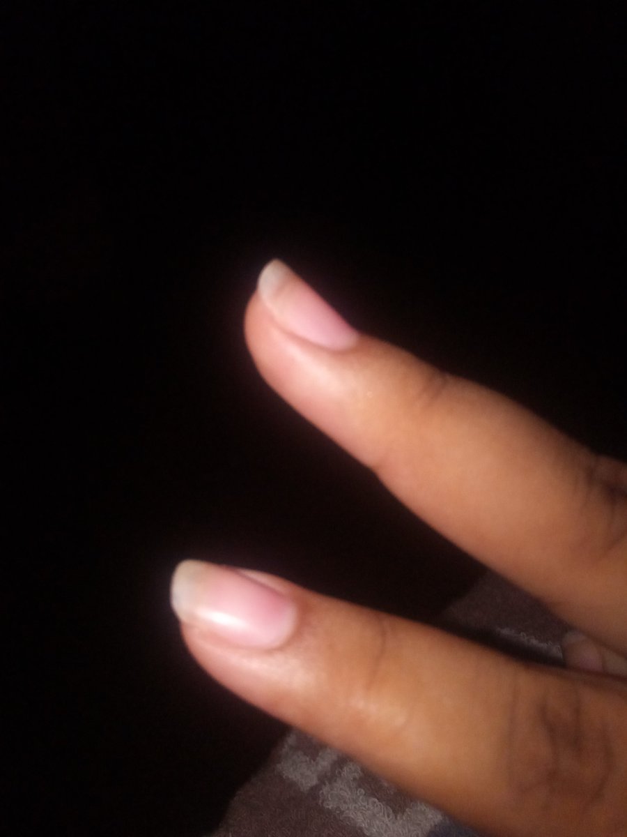 adicctoeb's tweet photo. Pregunta sería. ¿ Te puedes masturbar teniendo las uñas algo largas?.

Adjunto foto de cómo se ven mis uñas. https://t.co/RzoRITl6L0