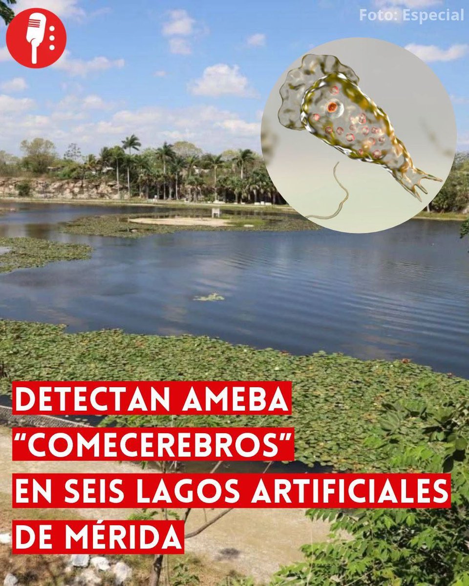 Saceci's tweet photo. 📷 OJO | DETECTAN AMEBA “COMECEREBROS” EN SEIS LAGOS ARTIFICIALES DE MÉRIDA; PROHÍBEN EL CONTACTO CON EL AGUA
Los Servicios de Salud de Yucatán (SSY) detectaron la ameba Naegleria fowleri, conocida como “comecerebros”, en seis de nueve lagos artificiales analizados en Mérida. La revisión se amplió después de que, en septiembre, un instructor de wakeboard que trabajaba en el lago de Plaza La Isla muriera a causa de esta infección.
https://t.co/4psqknuJ9b