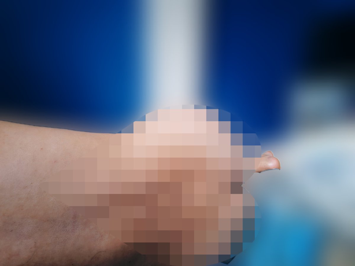 MisterNoirXx's tweet photo. Un poco de lo de hoy 😏💦😈🍑😋
Tremendo 🍑😜
Sin censura aquí ⬇️🍑
https://t.co/447e4K8EsF

#chudaiㅤ #wataa #madura #onlyfans #of #viral #casero #fyp https://t.co/bKOrpPebeU