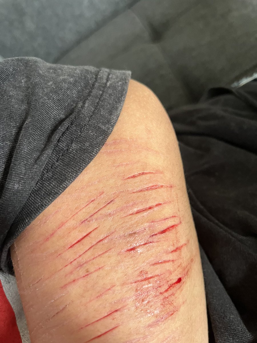 noaeastland's tweet photo. It’s make up it’s fake it’s Halloween make lol I am going as a depressed zombie lol https://t.co/Ja9yt1mQuQ