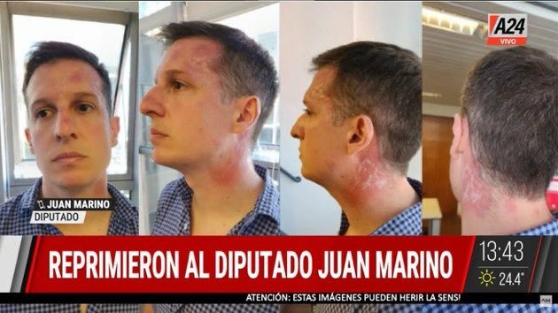 nosoypitti's tweet photo. como olvidar como terminó este mogolico la última vez que quiso jugar a hecerse el revolucionario: https://t.co/WPXr10KU5T