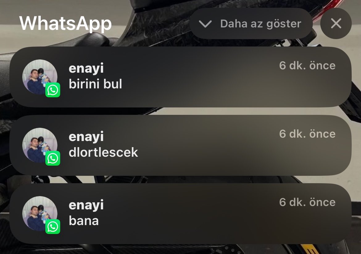 ryvenoi's tweet photo. kelın ılacı olsa basına surermıs https://t.co/tCAlrckYGN