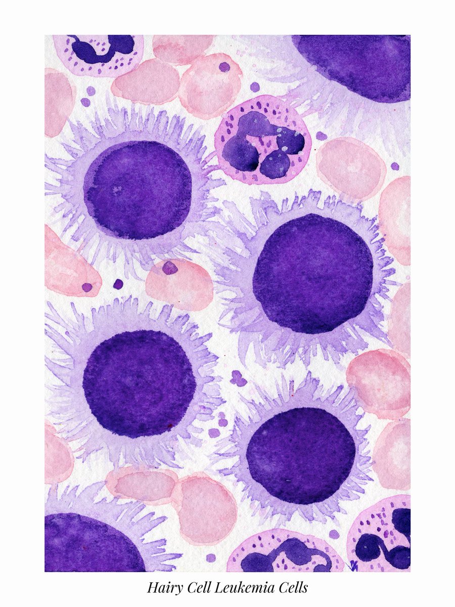 path_girl88's tweet photo. Negri Bodies and Hairy Cell Leukemia cells are my next spooky cells of October. #pathx #pathart #spookycelloctober #pathology #neuropath #hemepath https://t.co/pzx33ULDfP