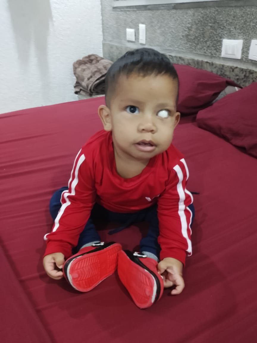 MamaLisVzla's tweet photo. Ares de 7 meses y Eidan de 14, ambos con retinoblastoma, necesitan apoyo para las prótesis oculares. Cada una tiene un costo de $1750, o sea las 1 son $3500, una meta difícil pero no imposible, así que vamos con fe hasta que lo logramos. 

Las estoy haciendo juntas porque ambos tienen la misma urgencia, y ninguno es más importante que el otro. 

Empezamos con mucha fe en los ángeles y en mis seguidores 🙏🏻🎗️

Cuentas para colaborar 👇🏻

Pago móvil Banco de Venezuela J-412719807/04142030483

Zelle Muniraf@bellsouth.net Munira Munoz 

Binance mamalisvzla@gmail.com 

https://t.co/nNbh4m9yJR