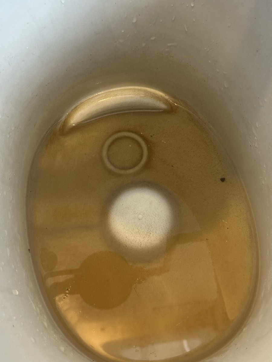 rojo_neon's tweet photo. Acá no tenemos agua desde antier, y aunque el sábado los periódicos locales y los diputados de MC aseguraban que el agua era cristalina como de manantial, esta mugre es la que se juntó en el filtro que cambié el pasado viernes.

Según el SIAPA, sólo nos iban a cortar miércoles y sábado.