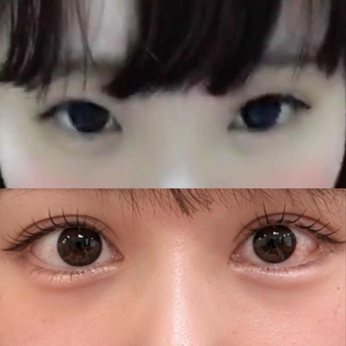Kj2Fo's tweet photo. 目の整形はマジで人生かわった❕🥹🥹
同一人物か怪し過ぎw w w
この世にこんな吊り目の人間いんの？てくらい目つき悪かったんだけどタレ目形成のおかげで丸くて可愛い目になれた‼️
Xでは有名じゃない先生だけど、要望通りがっつり切ってくれて感謝🫶🏻
もちろん目頭、全切開、眼瞼下垂などもしてますヨ⇦ https://t.co/Rf5Z9ZF2Il