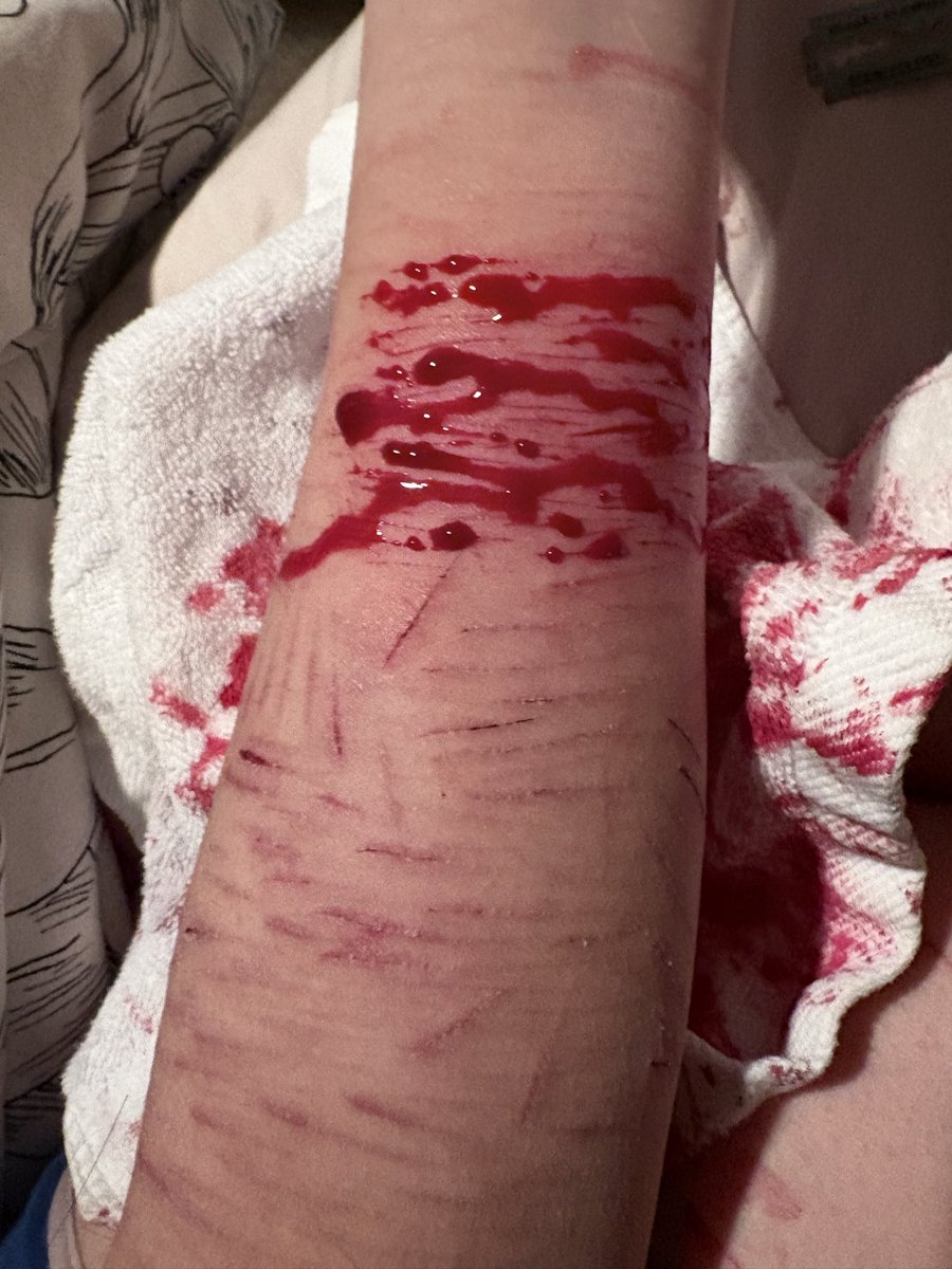 Kath_yyy's tweet photo. SEX MAKEUP, ALL Al, ALL MADE WITH SFX NO ONE GOT HURT ALL!!! https://t.co/Q3762U1Ith