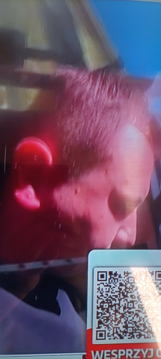 mdzik12's tweet photo. To ten tajniak zomowiec doprowadził do tego 
Pobili człowieka do nieprzytomności 
J3B*N3 ZOMO POgłosa 🤢🤮😡😡😡😡😡😡 Hańba 
ZOMO POgłosa ma krew na rękach 
ZOMO POgłosa to sadyści 
okazało się że ten pobity to prawdopodobnie żołnierz WP
SZOK 😡😡 https://t.co/KJiIoiscON