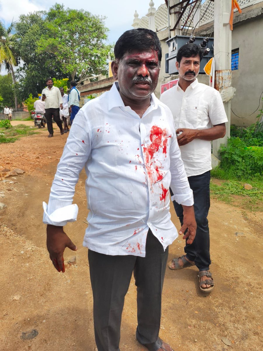 AndhraXpress's tweet photo. పుంగనూరు టీడీపీ రాళ్ల దాడిలో గాయపడిన 

@JaiTDP కార్యకర్తలు దాడి 

పెద్ది రెడ్డి పై దాడి 

వద్దు అన్న టీడీపీ వారిపై 

దాడి చేసిన టీడీపీ సైకో మూక https://t.co/hLJodVO8Im