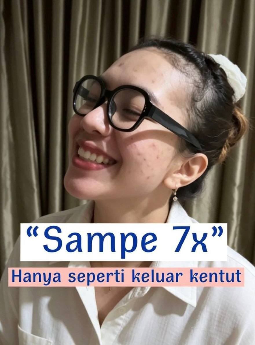 mzomoya's tweet photo. Sampe 7 loh ya

https://t.co/Qa0ojmZUB1 https://t.co/nqfNxYVgco