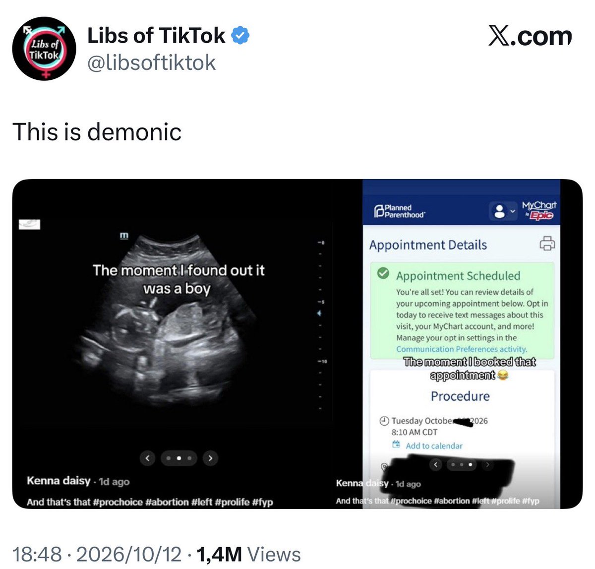 GersonPike's tweet photo. @curious_edline Seems fair to me especially now that mothers are targeting sons for abortion. https://t.co/IndYM3S3Z5