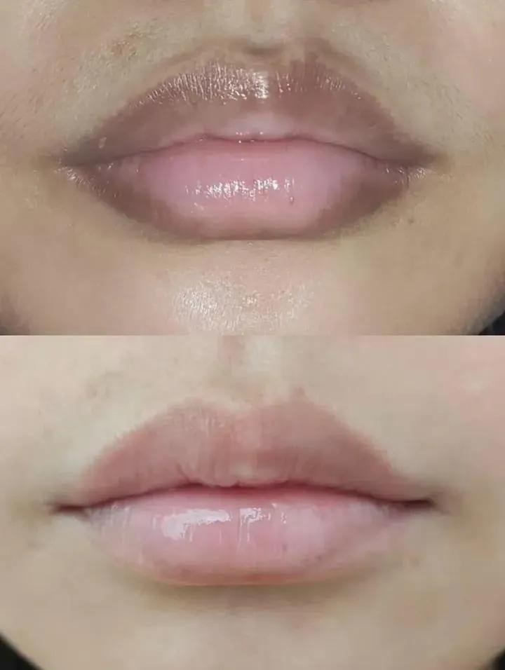 rainyychaa's tweet photo. yang punya bibir two tone cobain ini deh😭🫶

iseng nyobain lip care ini sebulan, bagian gelap di pinggir bibir pelan" warnanya mulai rata https://t.co/5oxzeEQo7U
