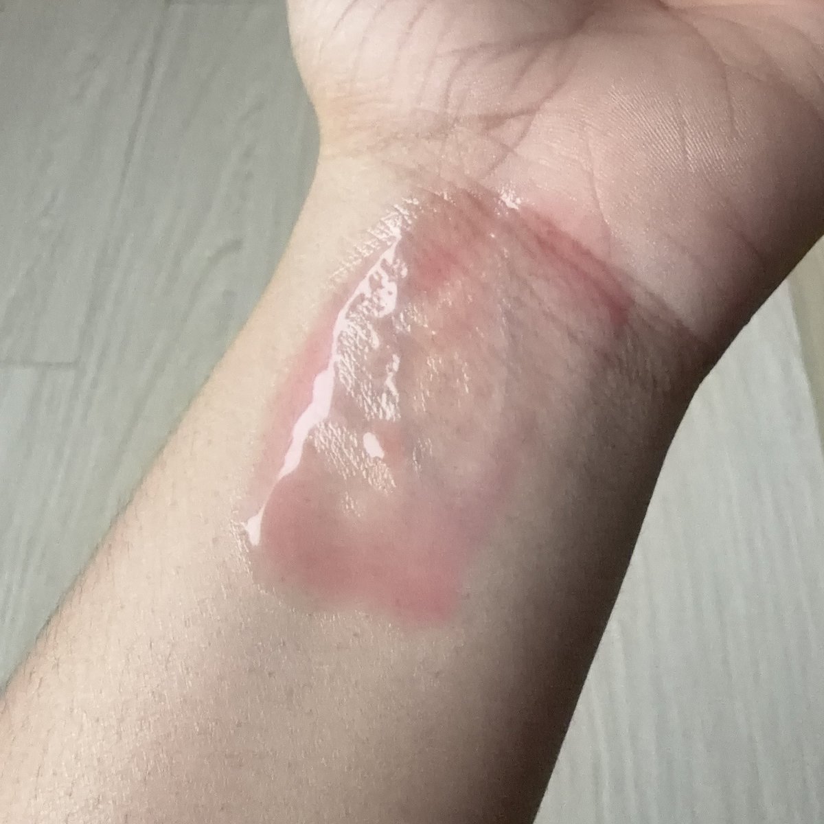 bbbumbbbu's tweet photo. เซรั่มแอสตาแซนธินของDr.skinne คือเหมาะกับคนไว้30+อย่างมากกก ตัวนี้ช่วยลดพวกริ้วรอยได้ดีเลย แถมลดรอยดำต่างๆได้และปรับสมดุลให้ผิวได้ด้วย เนื้อเซรั่มสีแดงซึมง่ายมากให้สิบสิบ⭐️⭐️⭐️⭐️⭐️

#skinne #drskinne #astaaox #เซรั่ม #serum https://t.co/RcIepwfK94