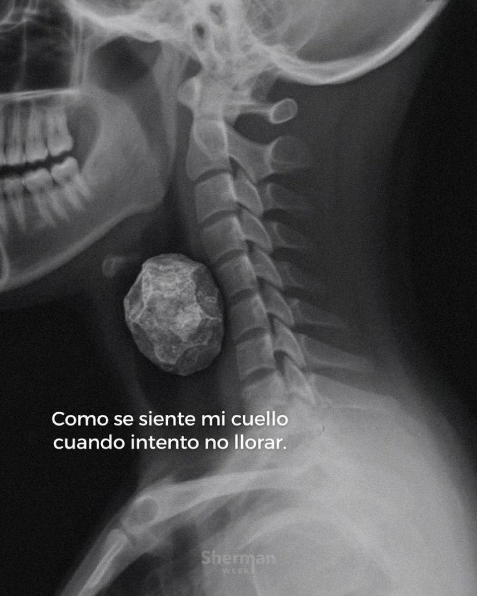 juanfhoms's tweet photo. https://t.co/G7cRLh3HW9