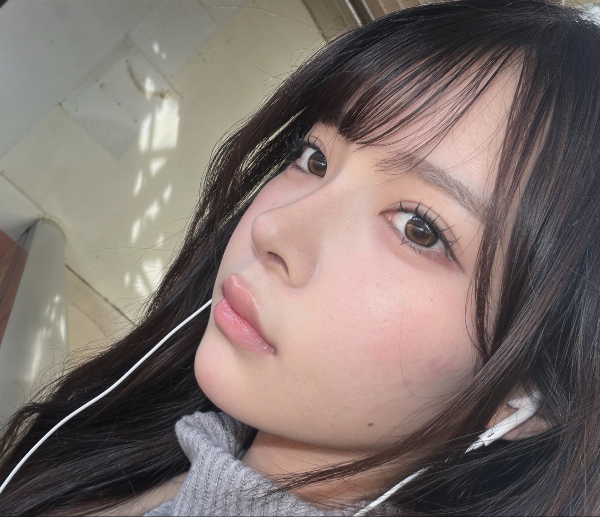 girl114girl's tweet photo. ギプスを外す前は高すぎたり派手になりすぎないか不安だったけど、完成した鼻は理想通りで本当に、感動😆脂肪移植のおかげで正面から見た顔の凹凸も目立たなくなって嬉しい限り🤩抜糸後も院長先生が詳しく説明してくれて、通訳の方もずっと一緒で安心でした😻改めてOMを選んで本当に良かったです❣️❣️ https://t.co/iJj1XegwOY