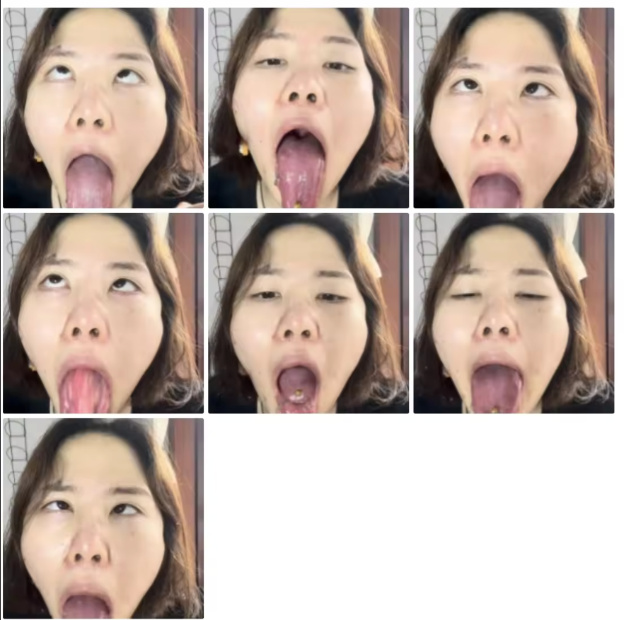 eatzhaoyi's tweet photo. puke with the weird face
#vomit #bigbelly #puke #vomit #vomit #gluttony #bloating #swallow #vore #endoscopy #endoscopy #endoscopy https://t.co/I7zACMxkt1