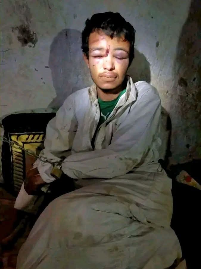 GhamdanQadri7u2's tweet photo. خداع الحوثي وتعامله مع الاسراء هذا الشاب اسمه جمعان أحمد مرشد اليشيعي من قرية يشع #محافظةعمران كان جنديا في قوات الجيش بالجوف واقنعه أصحابه بالعودة تحت عفو الحوثي وبعد عودته اختطافه في بني عبد بمديرية عيال سريح وتم تعذيبه حتى

فقد عقله

الحوثي لا عهدله https://t.co/CrWf45UOb5