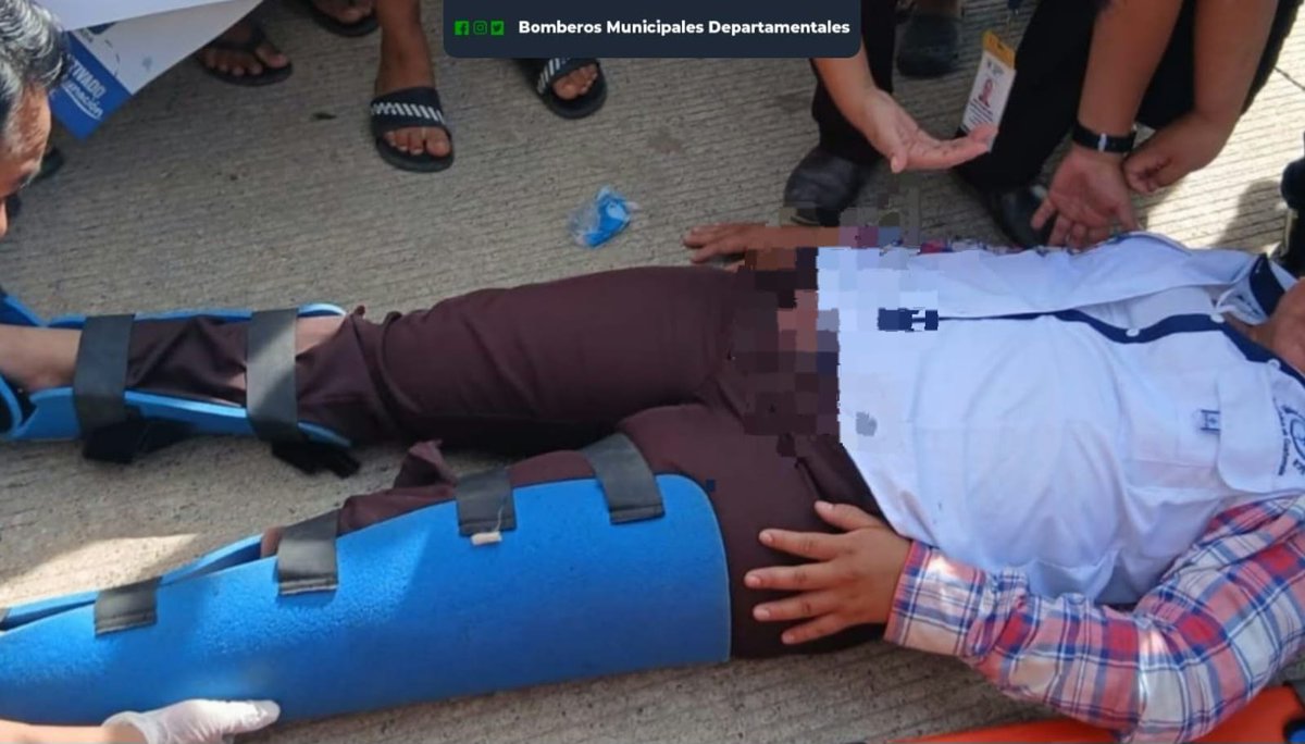 EUCoban's tweet photo. Motorista herida al chocar contra automóvil.
Bomb. M. Dept. de La Tinta acudieron al Km. 248 ruta RN-7E, aldea Xucup, Telemán, Panzós, para atender a María Can, 28 años, de Palestina, Panzós.  Presentaba posible fractura en las extremidades inferiores, fue rasladada al Hosp. https://t.co/VkYCxbizuG