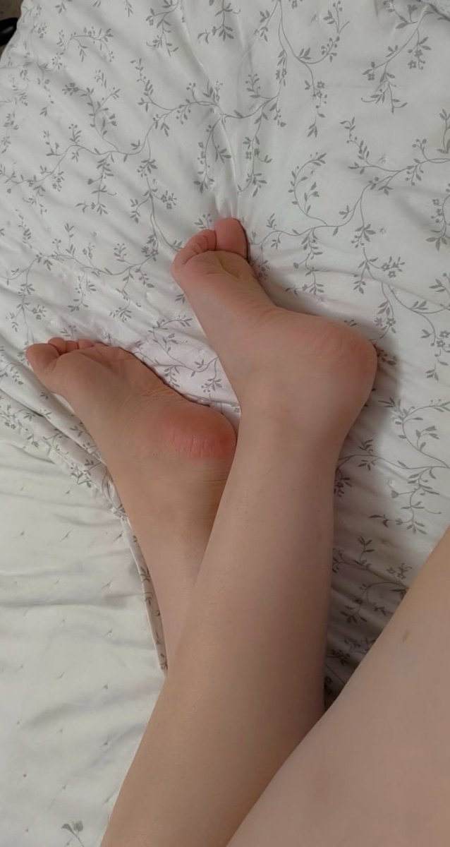 UnknownGoddessl's tweet photo. me chuparias los pies? https://t.co/WdRd8At5nS