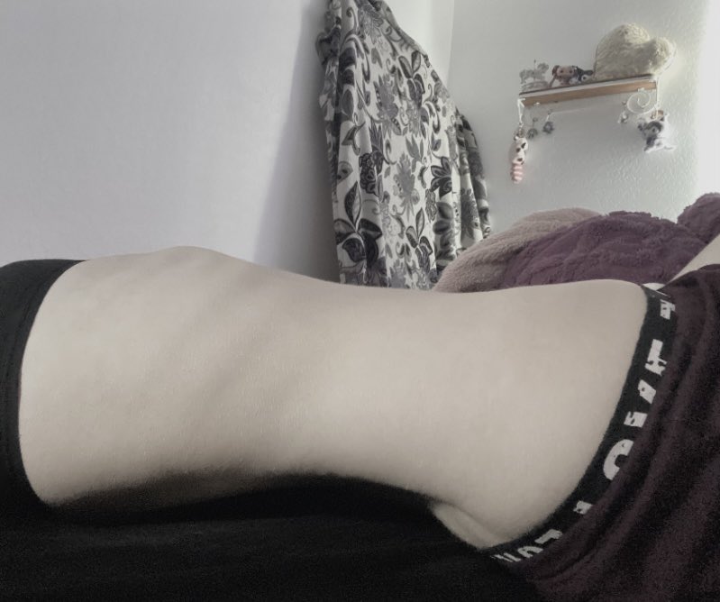 lacedpiano's tweet photo. 4 years into my ed and i got to a new hw this month 😭 kill me 😭😭 108 😭😭 

anyways now im at 105.4 thats bmi 16.8. going over bmi 15.5 is already terrifying for me and now look where im at…just give me the gun https://t.co/GZyyrK1bTE