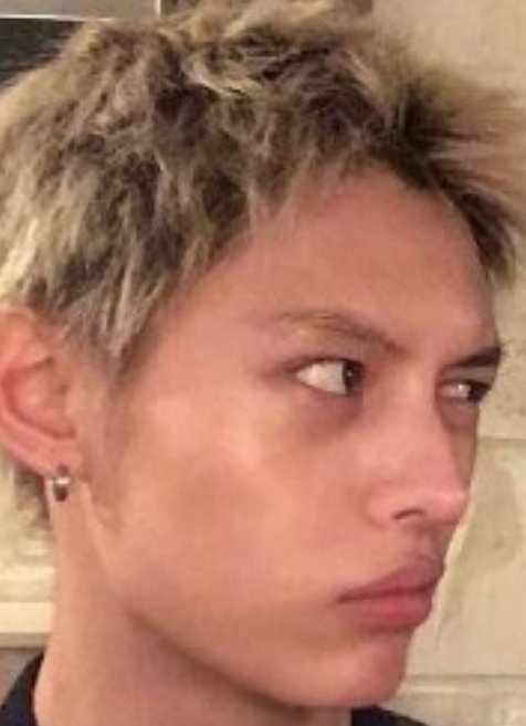 haoocakes's tweet photo. @majjubot amiga CUALES facciones lindas exactamente ?????

ni la operación lo salvó https://t.co/2me4PVjHGK