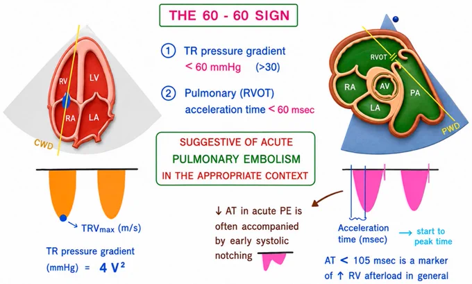 Image from NephroPOCUS (@NephroP)