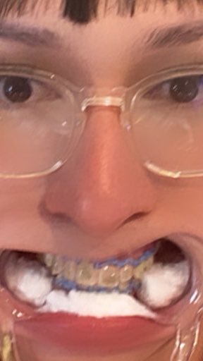 EllaLoveT's tweet photo. Me estuve haciendo blanqueamiento dental (si, ya no tengo brackets) mañana me harán mi diseño de sonrisa y pedí… colmillos 👹

A ver si les subo después el resultado https://t.co/AulC6bEVFq