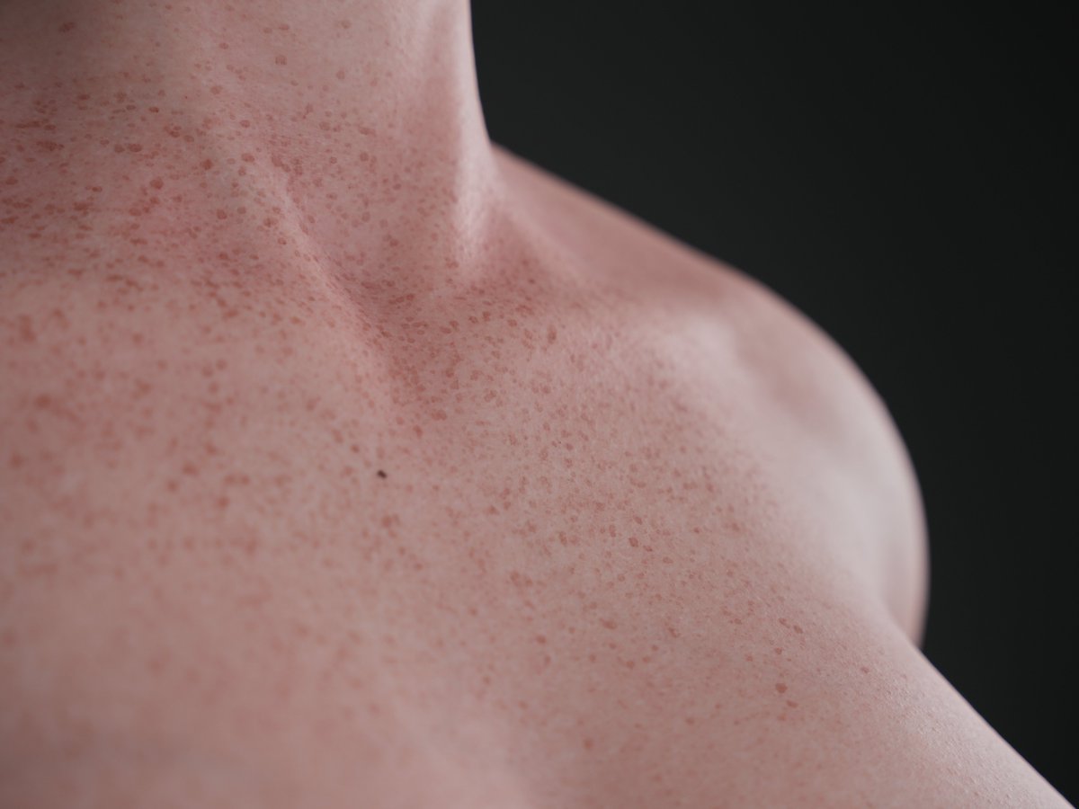 BB_TCYOFFICIAL's tweet photo. Explore TOPCYDOLL's Realistic Skin Texture!   Natural Skin Grains , Veins , Freckles and Bikini lines
@TOPCYDOLL
#TOPCYDOLL #Realisticdoll #Lifelikedoll #Siliconedoll #Freckles #Dolls #Realdoll https://t.co/DDae0ZByh6