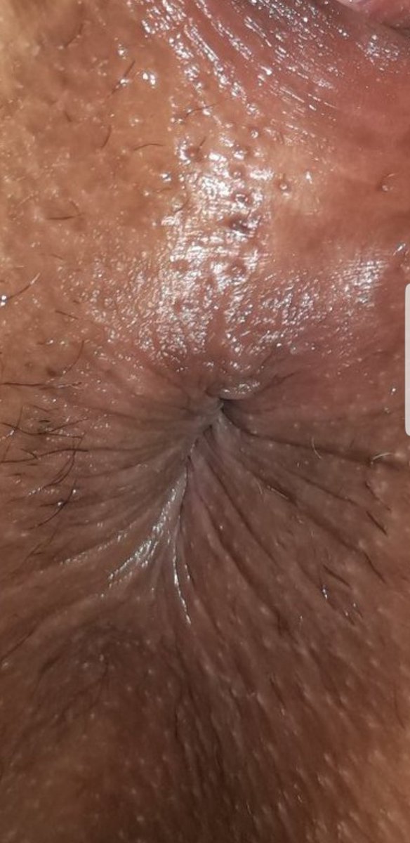 mirones69's tweet photo. Buenas noches mis corazones como se portan hoy viernes chiquito como el mio? https://t.co/KvEYJ3kDmY