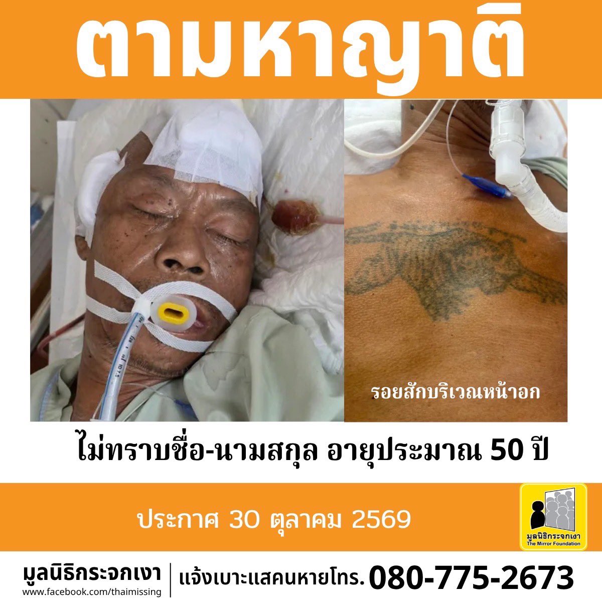 Mirror_org's tweet photo. ***ประกาศตามหาญาติ***
.
ผู้ป่วยเพศชาย ไม่ทราบชื่อ ไม่ทราบนามสกุล อายุประมาณ 50 ปี รูปร่างท้วม สูงประมาณ 170 ซม. น้ำหนักประมาณ 70 กก. ผิวดำแดง ผมสั้น ผมสีดำ มีตำหนิรอยสักบริเวณหน้าอกรูปเสือ
.
เมื่อวันที่ 18 ตุลาคม 2569 ศูนย์เอราวัณ นำส่งผู้ป่วยมีอาการบาดเจ็บที่ศีรษะ ไม่สามารถให้ข้อมูลตนเองได้ ไม่มีเอกสารแสดงตัว โรงพยาบาลภูมิพลอดุลยเดชมีกระบวนการติดตาม คัดข้อมูลทางทะเบียนราษฎรแล้ว แต่ไม่พบข้อมูล 
.
ทั้งนี้หากท่านใดเป็นญาติ หรือรู้จักกับชายในภาพ กรุณาติดต่อ ศูนย์ข้อมูลคนหาย มูลนิธิกระจกเงา โทร 080 775 2673
.
ประกาศนี้ได้รับการอนุญาตจากโรงพยาบาลภูมิพลอดุลยเดช  
ประกาศเมื่อ 30 ตุลาคม 2569

#คนหาย
