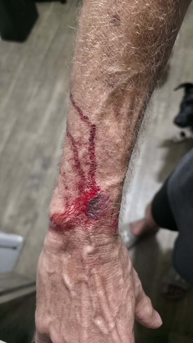 tond600's tweet photo. I could use your help with my fundraiser on GoFundMe. Please share, support, or donate—every small action counts. https://t.co/581GnqIV2v
#SpousalAbuse #domesticviolence #abuse #gofundme https://t.co/Mh4kNrywgc