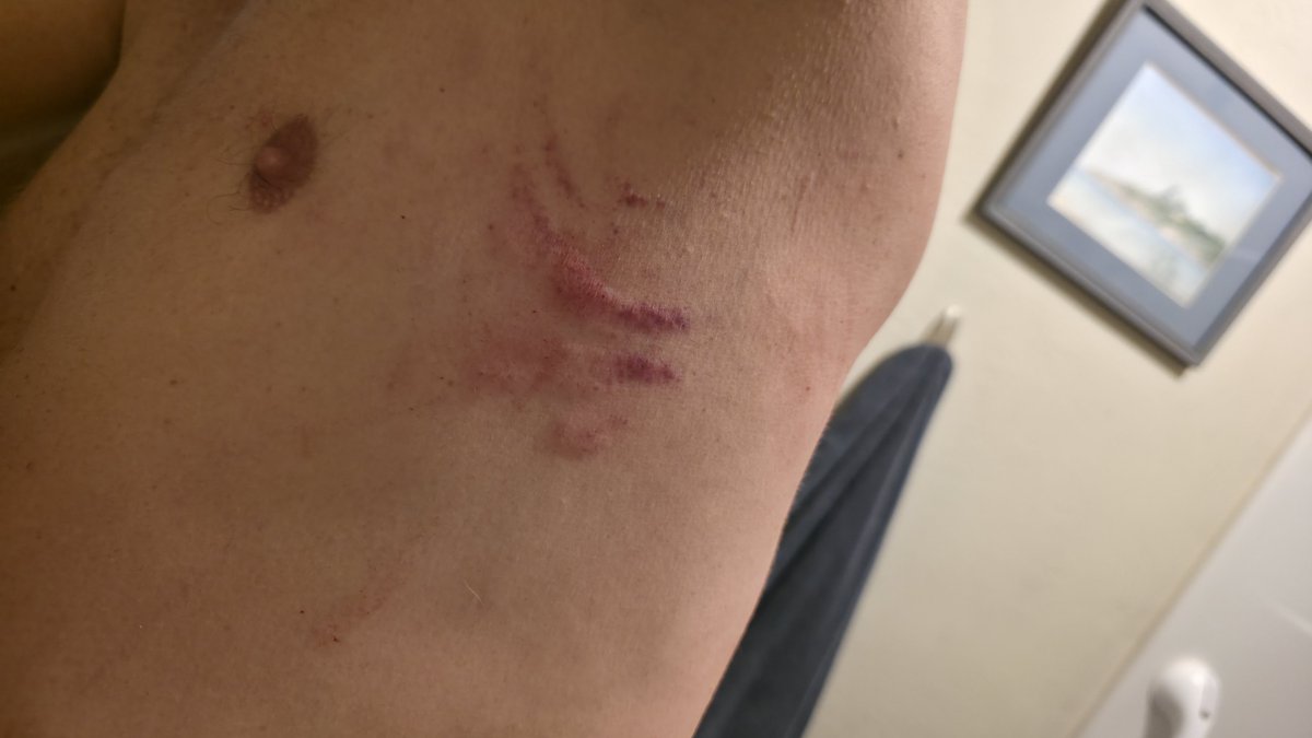 tond600's tweet photo. I could use your help with my fundraiser on GoFundMe. Please share, support, or donate—every small action counts. https://t.co/581GnqIV2v
#SpousalAbuse #domesticviolence #abuse #gofundme https://t.co/Mh4kNrywgc