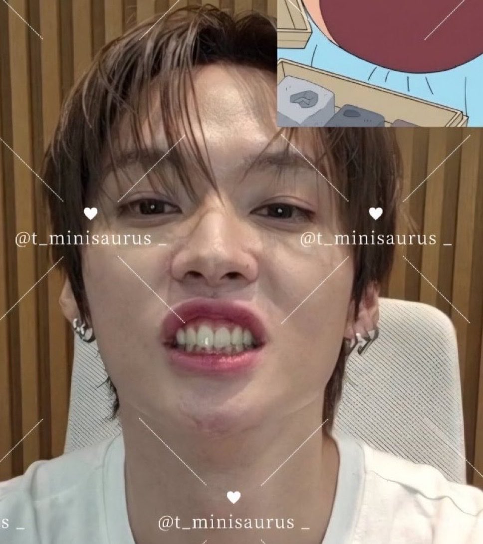 Iinogatinhos's tweet photo. LINO TEETH 🦷🦷🦷🦷🦷🦷🦷🦷🦷🦷🦷🦷🦷🦷🦷🦷🦷🦷🦷🦷🦷🦷🦷🦷🦷🦷🦷🦷🦷🦷🦷🦷🦷🦷🦷🦷🦷🦷🦷💧💧💧💧💧💧💧💧💧💧💧💧💧💧💧💧💧💔💔💔💔💔💔💔💔💔💔💔💔🥺🥺🥺🥺🥺🥺🥺 https://t.co/CPJJDzMqYx