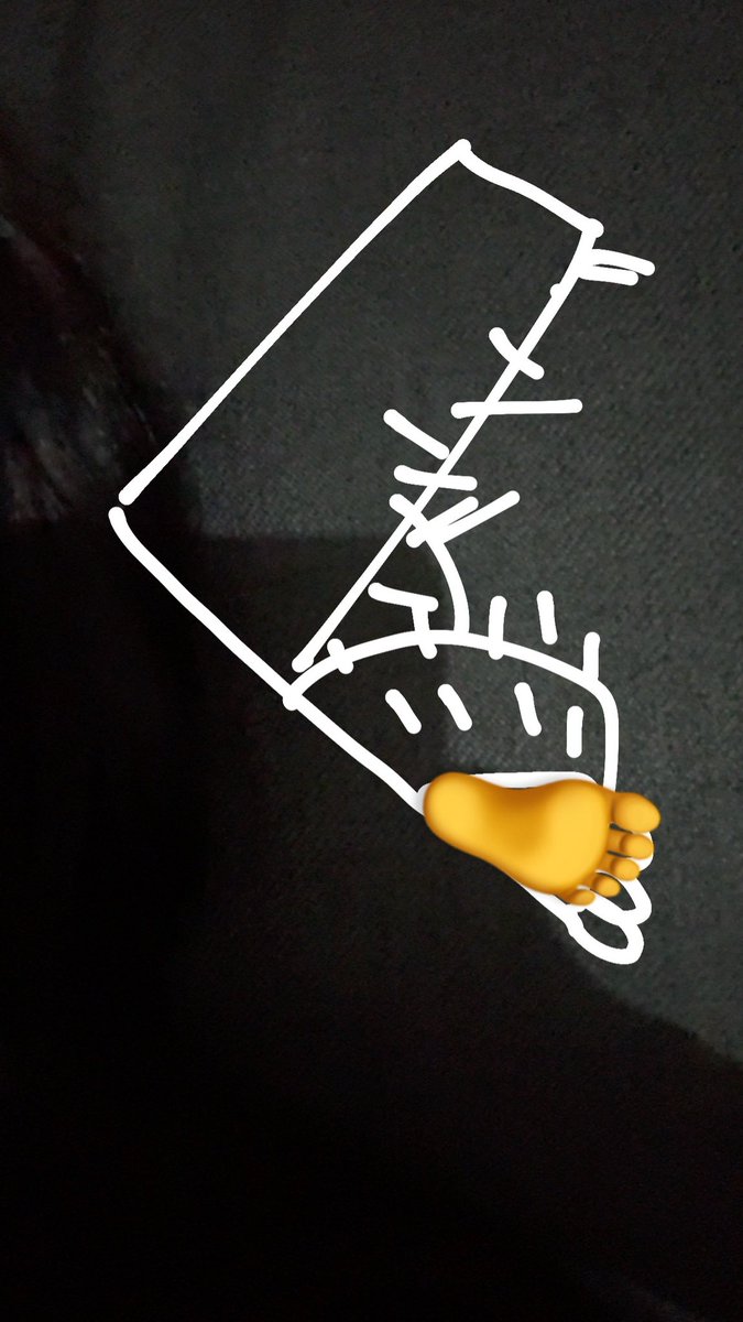 litflest's tweet photo. @disappe_ring Ur shoes look like fucking sandals
Like this https://t.co/75qm2X0qBO