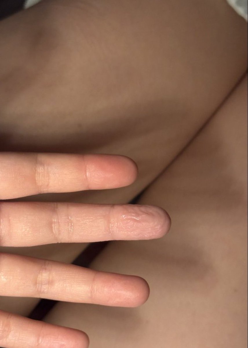 Hj1Ra's tweet photo. 1つしか入れない😵‍💫🥴 https://t.co/cHTrOUeUZO