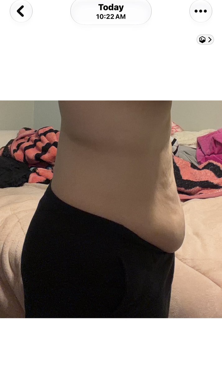 petrotting's tweet photo. march vs october .... is there much difference? #bodycheck #wl #edrtwt https://t.co/aV1V9BeQVp