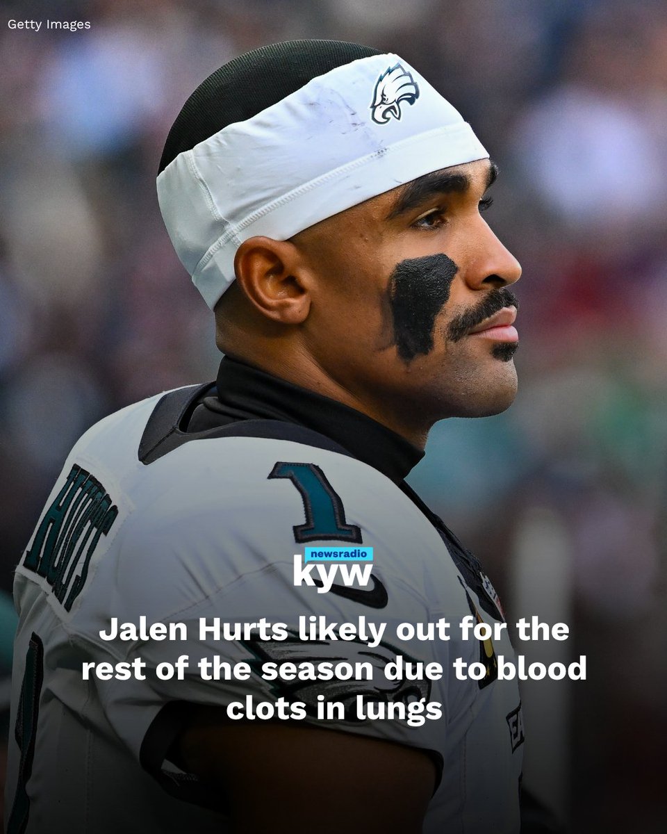 KYWNewsradio's tweet photo. BREAKING: Jalen Hurts is likely out for the rest of the season. The Eagles and Hurts’ agent announced that his diagnosis has been upgraded to deep vein thrombosis and bilateral pulmonary emboli. https://t.co/ROxLnsJWEk