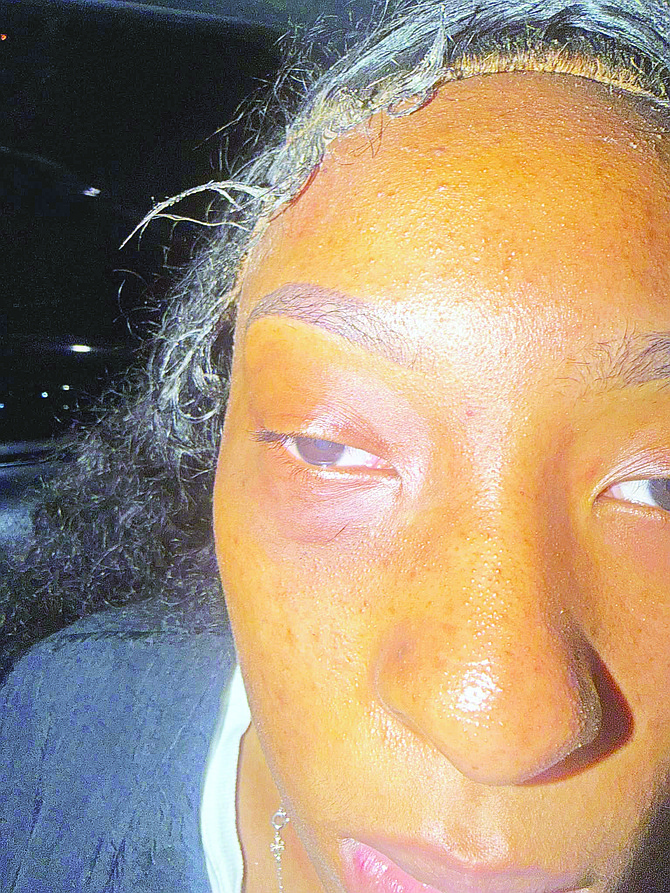 Tribune242's tweet photo. PROBE LAUNCHED AFTER POLICE STATION 'IGNORED' MOM'S ABUSE COMPLAINT
THE RBPF has launched an investigation after a mother accused officers at East Street South Police Station of refusing her complaint that she was beaten by her son’s father and his aunt.
https://t.co/CBdJg3tRzK https://t.co/pLSaiC6LXz