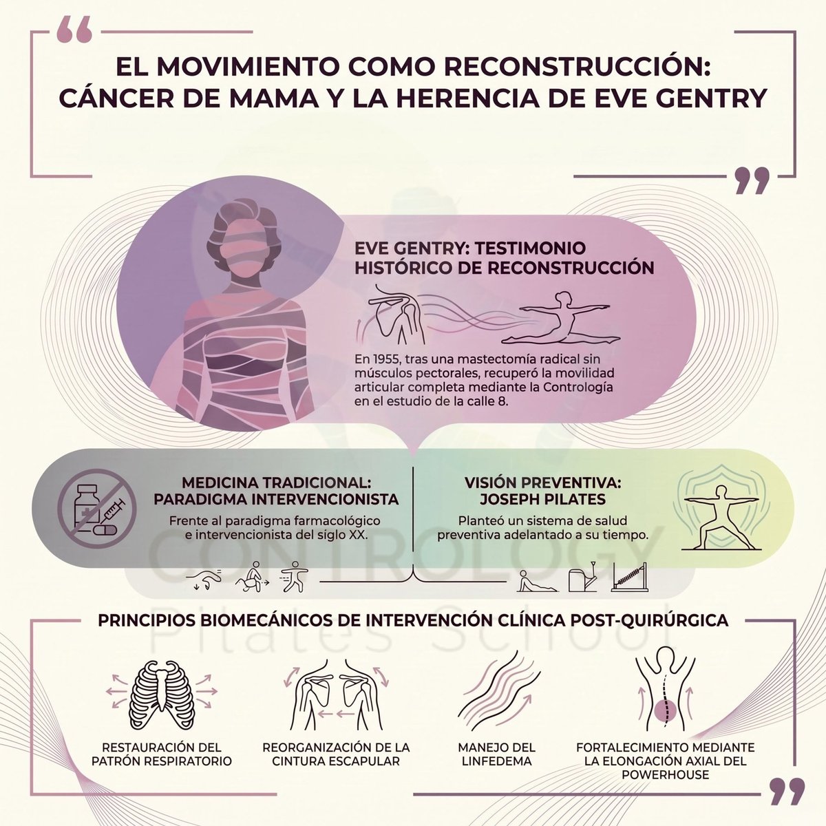 MiPilatesStudio's tweet photo. ¿Es posible recuperar la movilidad total del hombro tras una mastectomía radical sin músculos pectorales? 🩷🎗️
La historia clínica de la maestra Eve Gentry en 1955 demostró que la precisión de la Contrología puede reescribir la historia. #CancerDeMama 🌸 https://t.co/SQQVETa3xa