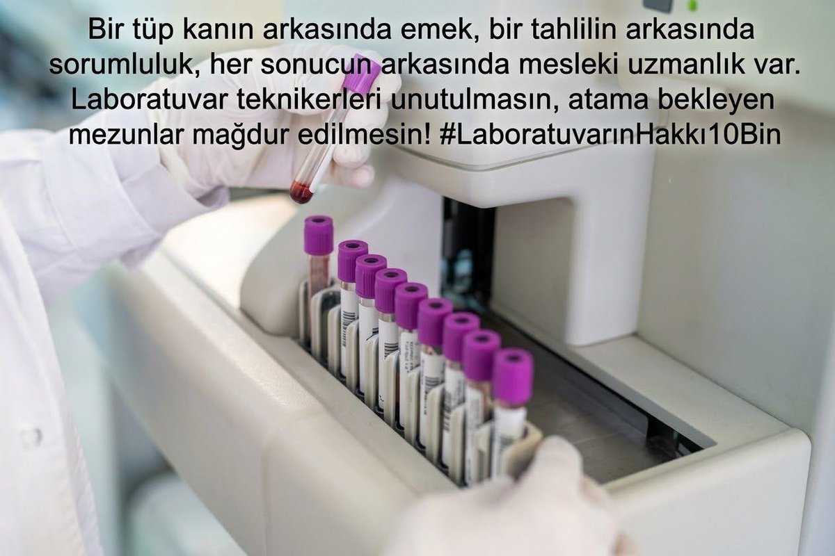 sevgilgizz's tweet photo. #LaboratuvarınHakkı10Bin https://t.co/YDEhhlFNGo