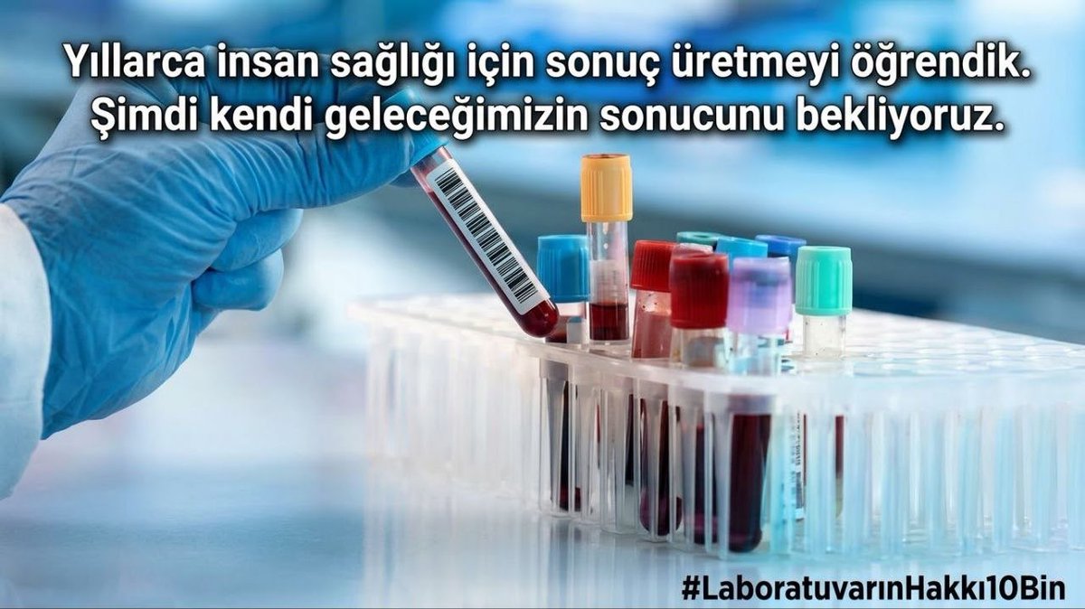 sevgilgizz's tweet photo. #LaboratuvarınHakkı10Bin https://t.co/oqYBodR8gk