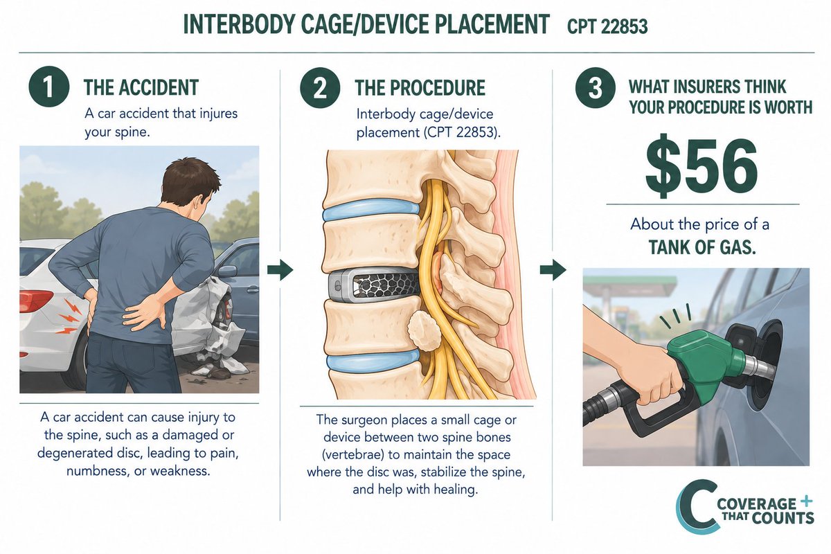 CoverUsNow's tweet photo. Imagine surviving a car accident only to need surgery for a literal CAGE to hold your spine together. Your insurance company? Offering your surgeon the equivalent of a tank of gas. They'll spare no expense protecting their profits. Your spine? That's where they draw the line. https://t.co/HP9gRWU64p