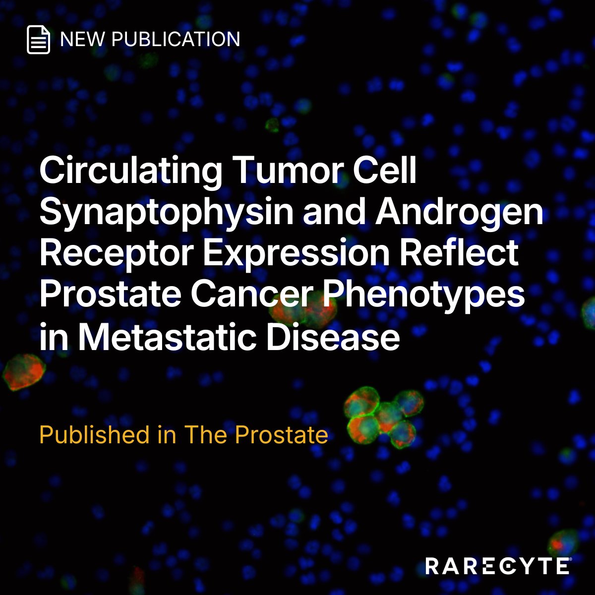 RareCyte's tweet photo. How well do circulating tumor cells (CTCs) reflect the biology of a patient’s tumor? 🤔

A new study from UW provides compelling evidence that CTC protein expression can reflect key tumor characteristics in patients with advanced prostate cancer.

https://t.co/vZlx1rtsrA https://t.co/axo92jbR2O