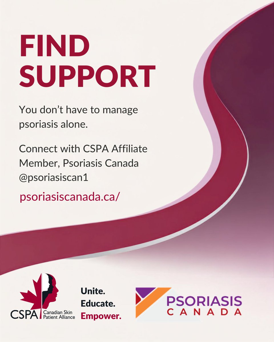 CanadianSkin's tweet photo. October 19 is National Psoriatic Arthritis Day, an inflammatory form of arthritis that can cause joint pain &amp; swelling, &amp; it can affect people living with psoriasis.  About 1/ 3 people with psoriasis will develop psoriatic arthritis. Learn more at https://t.co/3EMRNLo1Vm. https://t.co/BnuYyi3hdu